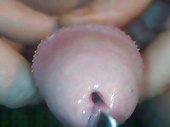 TDD13-Urethra sounding and Cum